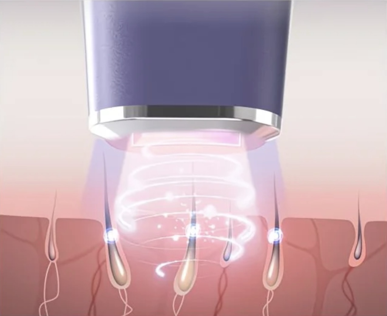 光テクノロジー